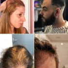 Egy nő frizurája